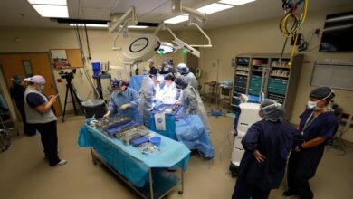 More organs are being donated after the heart stops, not brain death. Policies are changing too