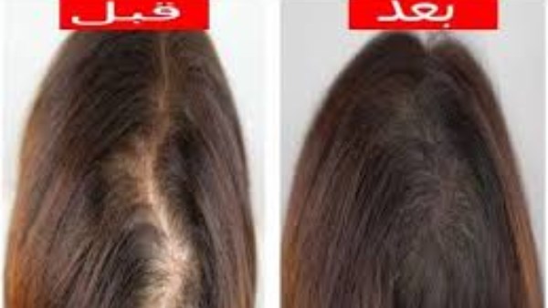 ماذا يحدث لشعرك عند استخدام ماسك الليمون؟ 1 6202055615386202501200323202320