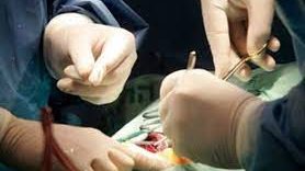 مصر تخطو بثقة في مجال زراعة الأعضاء 5 690