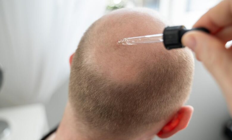 GettyImages 2157410170