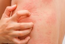 6241674701884202601210610211021