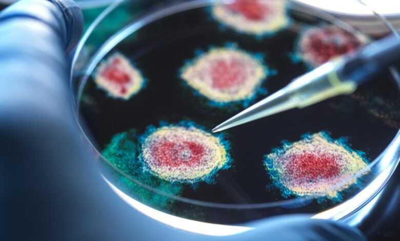 GettyImages 2081441965