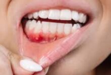 594677143268202602010658595859