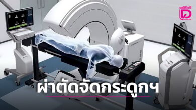 ผ่าตัดจัดกระดูกสันหลัง ทางออกป้องกันปัญหาในอนาคตให้สาววัยรุ่น