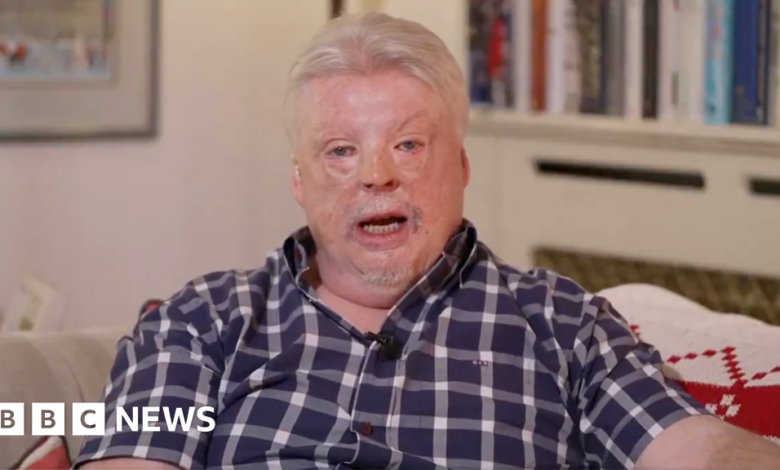 Falklands Veteran Urges King Charles to Intervene with Trump