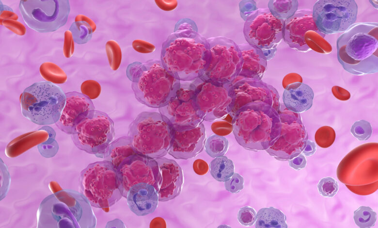 Incidência de mieloma múltiplo em Cabo Verde acima da média mundial