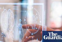 AI surpasses doctors in emergency triage diagnoses