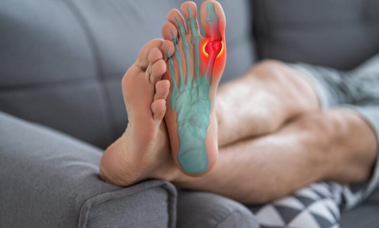 Hallux valgus: Moderne Diagnostik und Therapiewege
