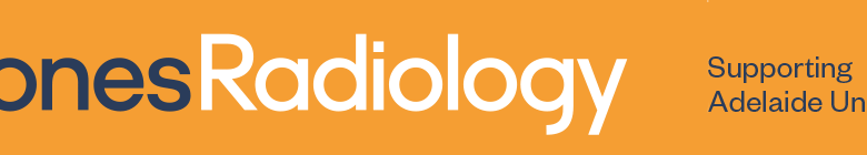 ALM Squad Selection: Adelaide United names Round 25 squad vs Macarthur