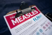 Measles in South Carolina: What Misryoum learned and why it still matters