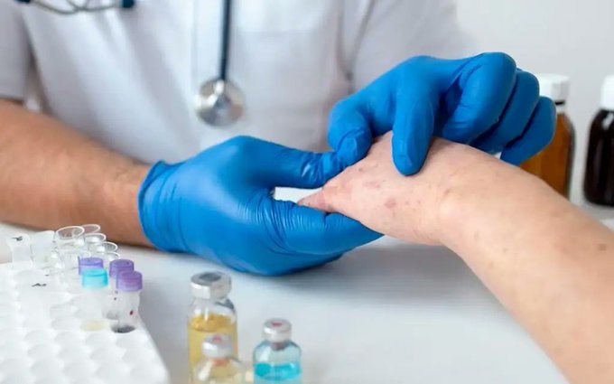 Inteligjenca artificiale ul vdekshmërinë nga goditja në tru me 40%