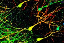 Compound X boosts brain cleanup in Parkinson’s mice