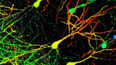 Compound X boosts brain cleanup in Parkinson’s mice
