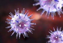 Huge study links Epstein-Barr virus to multiple sclerosis