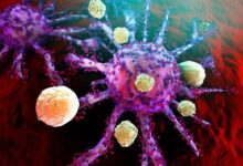 CAR T-Cells Offer Hope for Autoimmune Cures