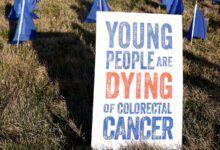 Cancer in Young Adults Rises, Causes Still Unclear