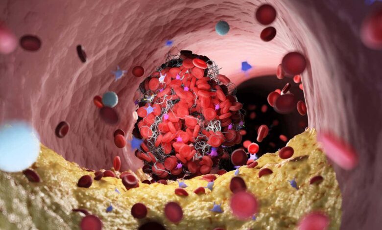 Tweak to red blood cells stops severe bleeding in seconds