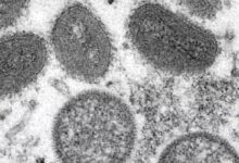 DOH detected mpox in Oahu wastewater—what it means for residents