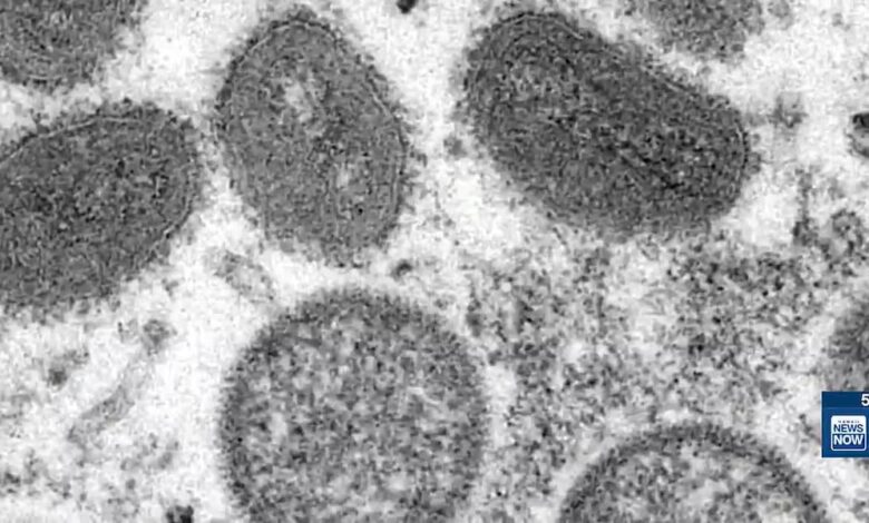 DOH detected mpox in Oahu wastewater—what it means for residents