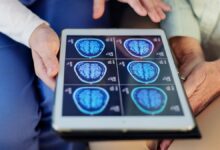 Fish oil and brain repair: new study raises concerns