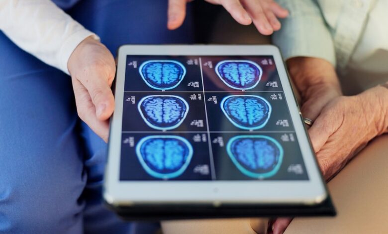 Fish oil and brain repair: new study raises concerns
