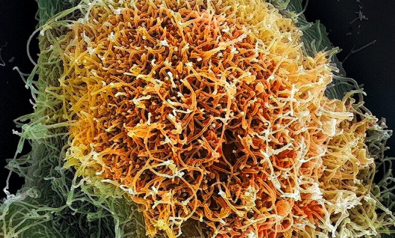 New Ebola and Hantavirus Outbreaks Confound Science