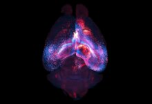 Newly mapped brain networks link far-flung regions