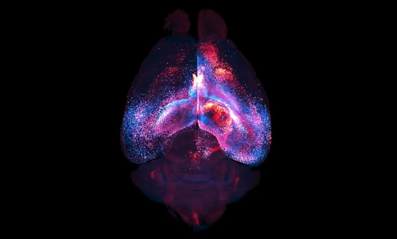 Newly mapped brain networks link far-flung regions