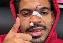 Morgan Gibbs-White shows off result of his horror head injury during Nottingham Forest's win at Chelsea - just days before Europa League semi-final second leg against Aston Villa
