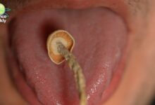 Psychedelic Therapy Push: What Science Says