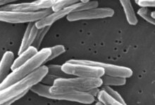CDC: Large TB outbreaks doubled since 2017