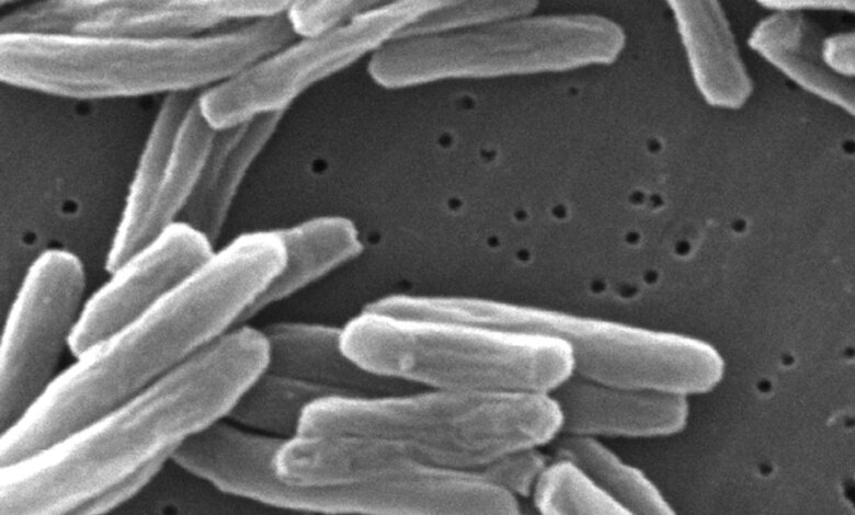 CDC: Large TB outbreaks doubled since 2017 CDC: Large TB outbreaks doubled since 2017