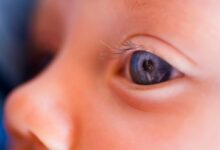 How a vision-restoring gene therapy proved that we can treat inherited diseases