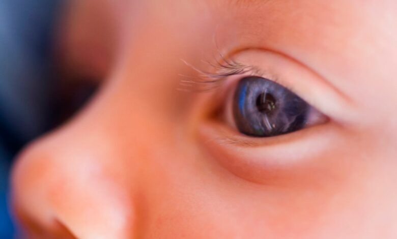 How a vision-restoring gene therapy proved that we can treat inherited diseases