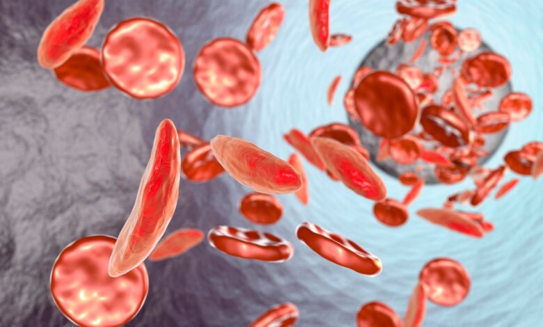 The scientists whose work led to a game-changing therapy for sickle cell disease worry those most vulnerable can’t access it