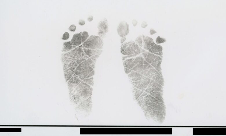 Autopsies Detail Preventable Deaths After Vitamin K Refusal Autopsies Detail Preventable Deaths After Vitamin K Refusal