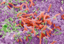 Oral microbiome links to weight, diabetes risk
