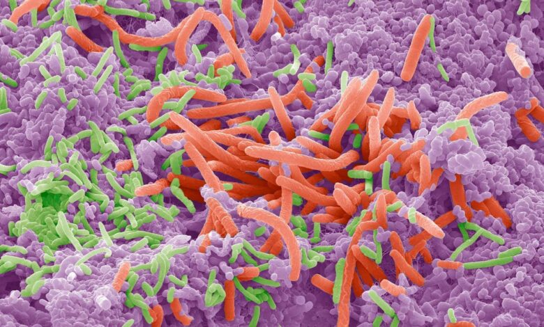 Oral microbiome links to weight, diabetes risk