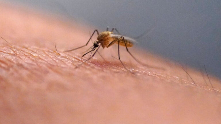 Scientists warn scratching bug bites fuels swelling cycle