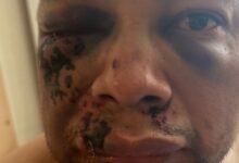 Man Demands Police Treat His Alleged Beating By ICE As A Crime