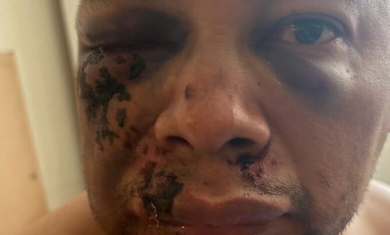 Man Demands Police Treat His Alleged Beating By ICE As A Crime Man Demands Police Treat His Alleged Beating By ICE As A Crime