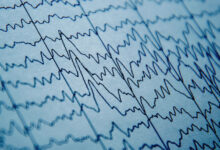 U.Va. researchers think they know why some with autism struggle to communicate – WTOP News