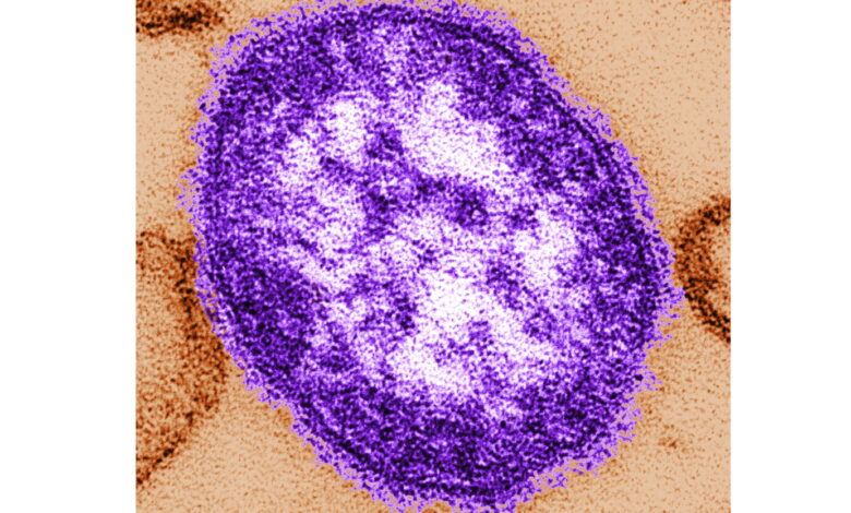 Confirmed measles case reported in Kane County Confirmed measles case reported in Kane County