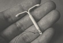 Is your IUD making your depression worse? What we still don’t know about women’s reproductive health