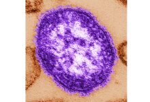Pennsylvania officials report state’s 3rd death involving measles – WTOP News