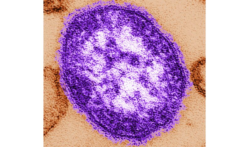Pennsylvania officials report state’s 3rd death involving measles – WTOP News Pennsylvania officials report state’s 3rd death involving measles – WTOP News