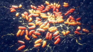 Russian Laboratory Death Sparks Investigation Into Rare Pneumonic Plague