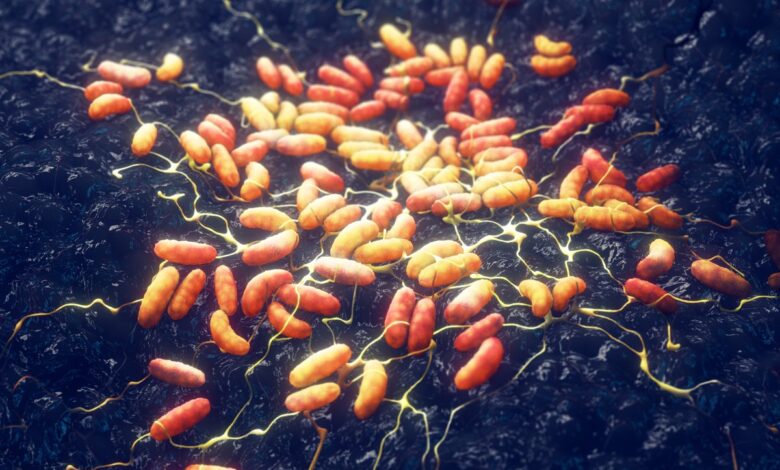 Russian Laboratory Death Sparks Investigation Into Rare Pneumonic Plague